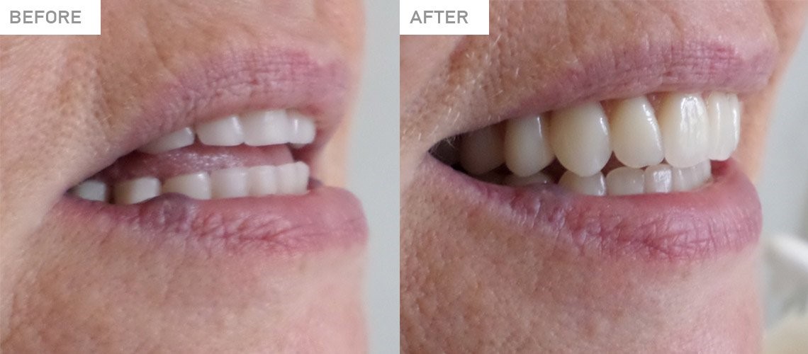 Dog Steals Dentures Ruston LA 71272